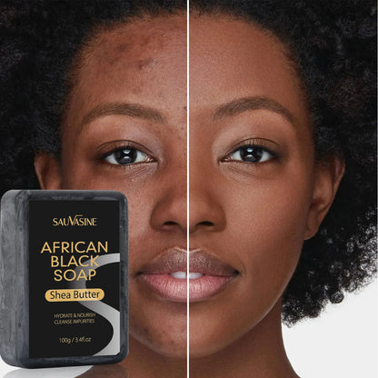 Savon Noir Africain Purifiant — African Black Soap 100g