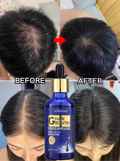 Sérum de Croissance Capillaire — Anti-Perte, Réparation & Massage Cuir Chevelu