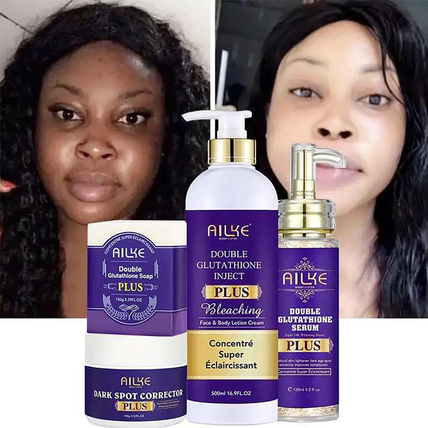 AILKE Crème éclaircissante pour la peau premium – Correcteur de taches foncées pour un teint inégal – Visage, corps, aisselles, genoux, coudes, jointures