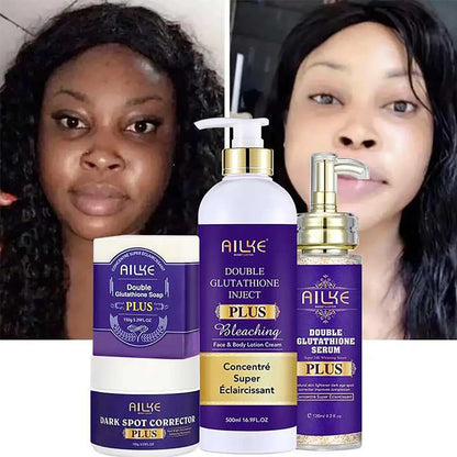 AILKE Crème éclaircissante pour la peau premium – Correcteur de taches foncées pour un teint inégal – Visage, corps, aisselles, genoux, coudes, jointures