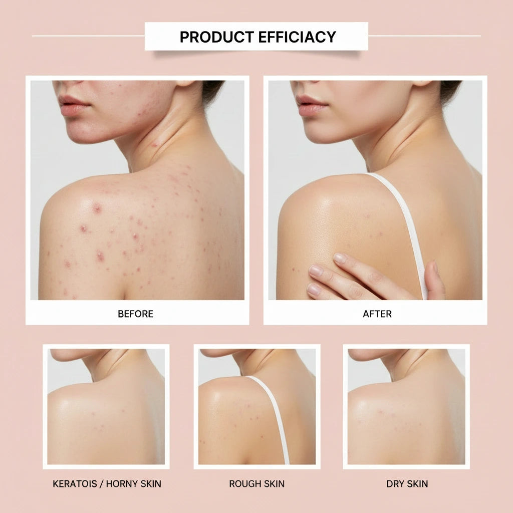Gel douche blanchissant au papaye, exfoliant, estompe, Pigmentation, arôme durable, huile de contrôle rafraîchissante, mousse riche, lavage du corps